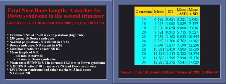 Fetal Nasal Bone Length Chart