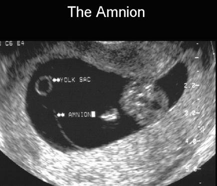 Fetal Membranes