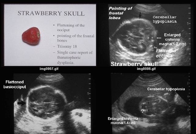 strawberry skull